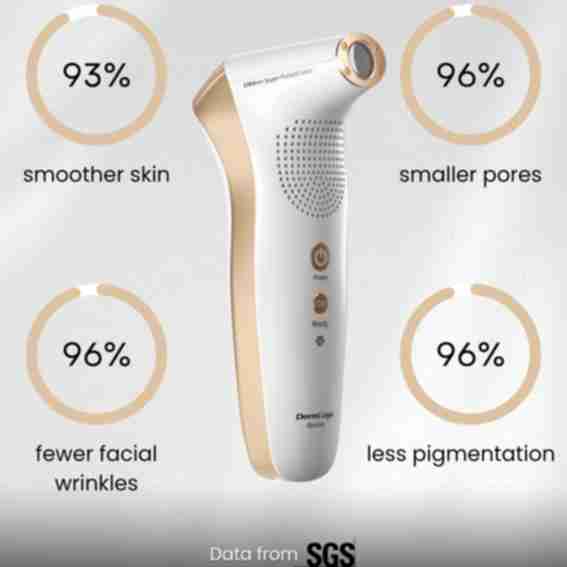 Lotuxs Laser Limited Reviews