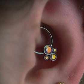 Anatometal