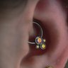 Anatometal